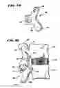 Fig. 16 - Facet arthroplasty devices and methods