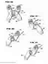 Fig. 17 - Facet arthroplasty devices and methods