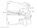 Fig. 01 - POSTERIOR STABILIZATION SYSTEMS WITH SHARED, DUAL DAMPENER SYSTEMS