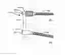 Fig. 01 - LOW PROFILE SPINAL PROSTHESIS INCORPORATING A CANNULATED BONE ANCHOR HAVING A DEFLECTABLE POST AND A COMPOUND SPINAL ROD
