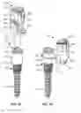 Fig. 03 - LOW PROFILE SPINAL PROSTHESIS INCORPORATING A CANNULATED BONE ANCHOR HAVING A DEFLECTABLE POST AND A COMPOUND SPINAL ROD