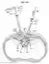 Fig. 40 - LOW PROFILE SPINAL PROSTHESIS INCORPORATING A CANNULATED BONE ANCHOR HAVING A DEFLECTABLE POST AND A COMPOUND SPINAL ROD