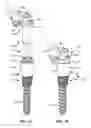 Fig. 02 - LOW PROFILE SPINAL PROSTHESIS INCORPORATING A CANNULATED BONE ANCHOR HAVING A DEFLECTABLE POST AND A COMPOUND SPINAL ROD
