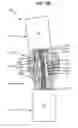 Fig. 30 - LOW PROFILE SPINAL PROSTHESIS INCORPORATING A CANNULATED BONE ANCHOR HAVING A DEFLECTABLE POST AND A COMPOUND SPINAL ROD