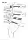 Fig. 37 - LOW PROFILE SPINAL PROSTHESIS INCORPORATING A CANNULATED BONE ANCHOR HAVING A DEFLECTABLE POST AND A COMPOUND SPINAL ROD
