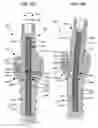 Fig. 45 - LOW PROFILE SPINAL PROSTHESIS INCORPORATING A CANNULATED BONE ANCHOR HAVING A DEFLECTABLE POST AND A COMPOUND SPINAL ROD