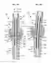 Fig. 47 - LOW PROFILE SPINAL PROSTHESIS INCORPORATING A CANNULATED BONE ANCHOR HAVING A DEFLECTABLE POST AND A COMPOUND SPINAL ROD
