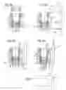 Fig. 06 - Bone anchoring device
