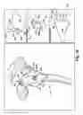 Fig. 09 - System and method for association of a guiding aid with a patient tissue