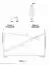 Fig. 02 - Implant stimulation device