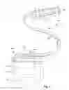 Fig. 02 - Percutaneously implantable paddle-type lead and methods and devices for deployment