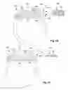 Fig. 03 - Percutaneously implantable paddle-type lead and methods and devices for deployment