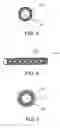 Fig. 04 - Medical implant