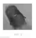 Fig. 05 - Medical implant