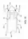 Fig. 07 - Method of manufacturing a catheter assembly