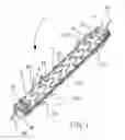 Fig. 02 - Removable stent-graft