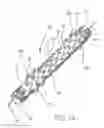 Fig. 03 - Removable stent-graft