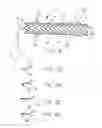 Fig. 05 - Removable stent-graft