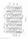 Fig. 13 - LONGITUDINALLY FLEXIBLE EXPANDABLE STENT