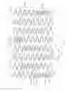 Fig. 14 - LONGITUDINALLY FLEXIBLE EXPANDABLE STENT