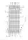 Fig. 15 - LONGITUDINALLY FLEXIBLE EXPANDABLE STENT