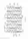Fig. 13 - LONGITUDINALLY FLEXIBLE EXPANDABLE STENT
