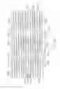 Fig. 07 - LONGITUDINALLY FLEXIBLE EXPANDABLE STENT