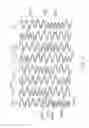 Fig. 13 - LONGITUDINALLY FLEXIBLE EXPANDABLE STENT