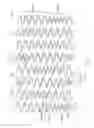 Fig. 14 - LONGITUDINALLY FLEXIBLE EXPANDABLE STENT