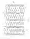 Fig. 03 - LONGITUDINALLY FLEXIBLE EXPANDABLE STENT