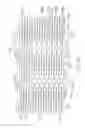 Fig. 05 - LONGITUDINALLY FLEXIBLE EXPANDABLE STENT