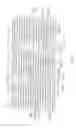 Fig. 07 - LONGITUDINALLY FLEXIBLE EXPANDABLE STENT