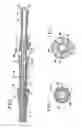 Fig. 02 - Prosthetic valve for transluminal delivery
