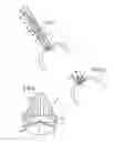 Fig. 03 - Prosthetic valve for transluminal delivery