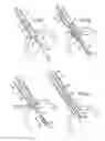 Fig. 04 - Prosthetic valve for transluminal delivery