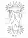 Fig. 18 - Prosthetic valve for transluminal delivery
