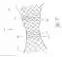 Fig. 30 - Prosthetic valve for transluminal delivery
