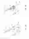 Fig. 34 - Prosthetic valve for transluminal delivery