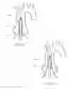 Fig. 37 - Prosthetic valve for transluminal delivery