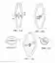 Fig. 41 - Prosthetic valve for transluminal delivery