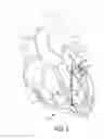 Fig. 03 - Heart valve implant