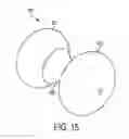 Fig. 16 - Heart valve implant