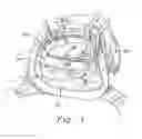 Fig. 02 - Three-dimensional annuloplasty ring