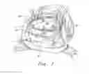 Fig. 02 - Three-dimensional annuloplasty ring