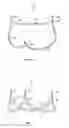 Fig. 04 - Aortic Valve Devices