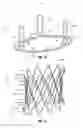 Fig. 08 - Aortic Valve Devices