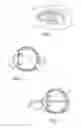 Fig. 02 - Corneal inlay with nutrient transport structures