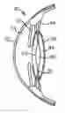 Fig. 01 - Intraocular lens having a haptic that includes a cap