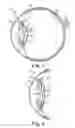 Fig. 02 - Intraocular lens having a haptic that includes a cap