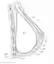 Fig. 01 - Prosthetic breast support